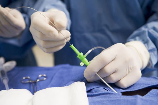 Cirurgia cardaca 'alternativa'  realizada pela primeira vez em MT com auxlio de mdico italiano