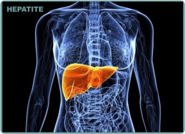 Dia mundial de luta contra a hepatite: Entenda a doença que pode causar cirrose e câncer