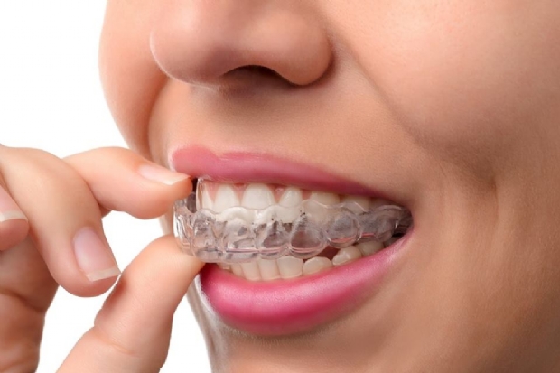 Bruxismo e placas dentais: quais os tipos e indicações