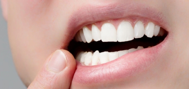 Cirurgiã Dentista fala os mitos e verdades sobre o dente do siso