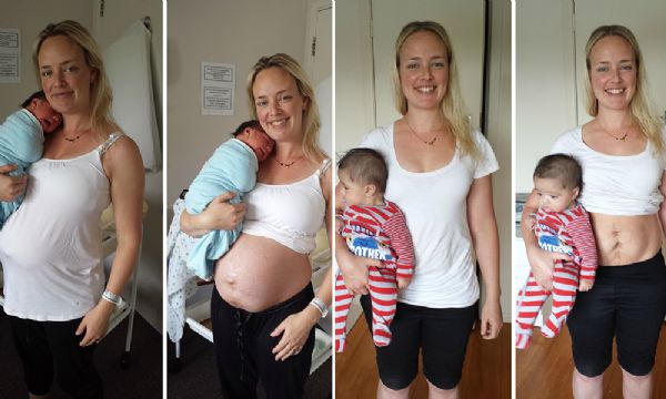 Mulher mostra barriga durante ps-parto pra questionar mulheres que saem saradas da maternidade
