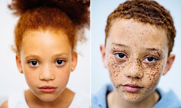 Fotgrafa explora a beleza da diversidade clicando pessoas ruivas e sardentas que no so brancas