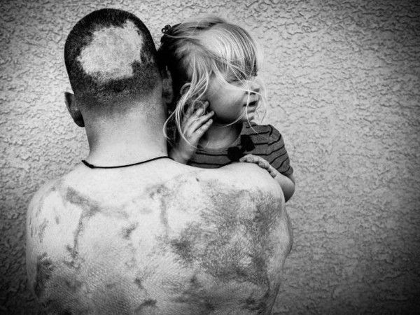 Fotgrafo mostra os efeitos da guerra em jovens que voltam para casa   Veja fotos 