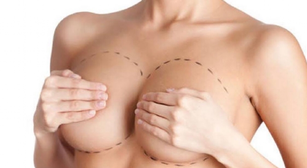 Como colocar implantes mamários e ter cicatrizes reduzidas?