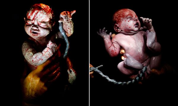 Ensaio fotogrfico impactante mostra bebs logo aps a cesrea