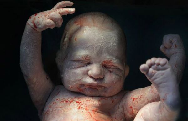 Fotgrafa faz registro impressionante de bebs na hora do nascimento;  Veja fotos 