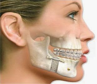 Tcnica menos invasiva trata disfuno na mandbula e acaba com dores e problemas de mastigao