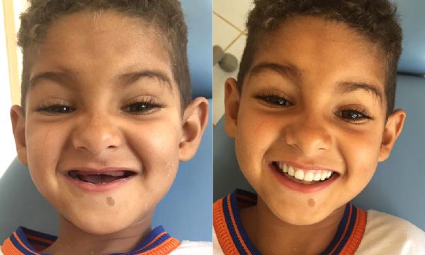 Dentista realiza desejo de menino na Bahia: ter dentes iguais aos dos colegas