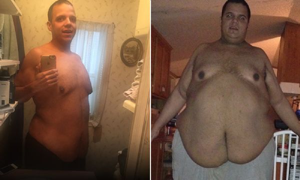 A jornada do homem que pesava mais de 300 kg e conseguiu emagrecer sem cirurgia