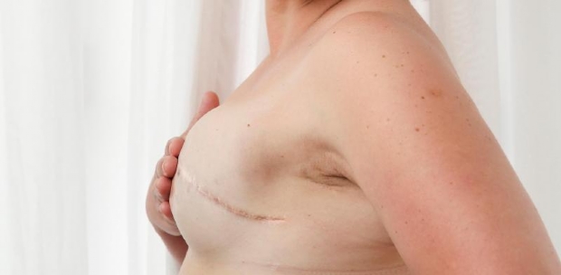 Direito desde junho de 2019, reconstruo de mamas pode devolver autoestima, diz cirurgio