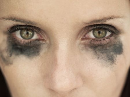 Dormir com maquiagem causa espinha e envelhecimento, diz dermatologista