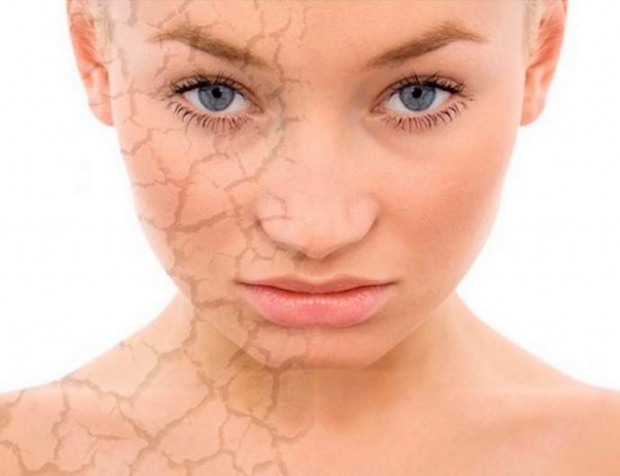 Minha pele pede socorro: dermatologista ensina o que fazer no tempo seco