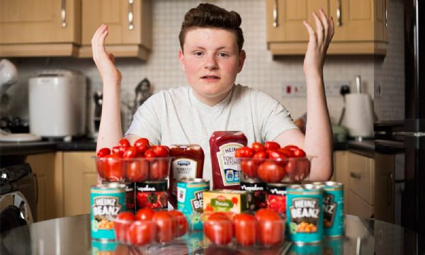 O estranho caso do adolescente que passou 12 anos se alimentando s de tomate